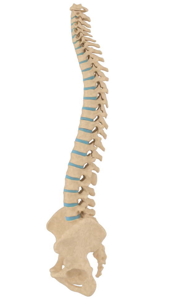 Sphereplast - interventi colonna vertebrale - mtortho.com